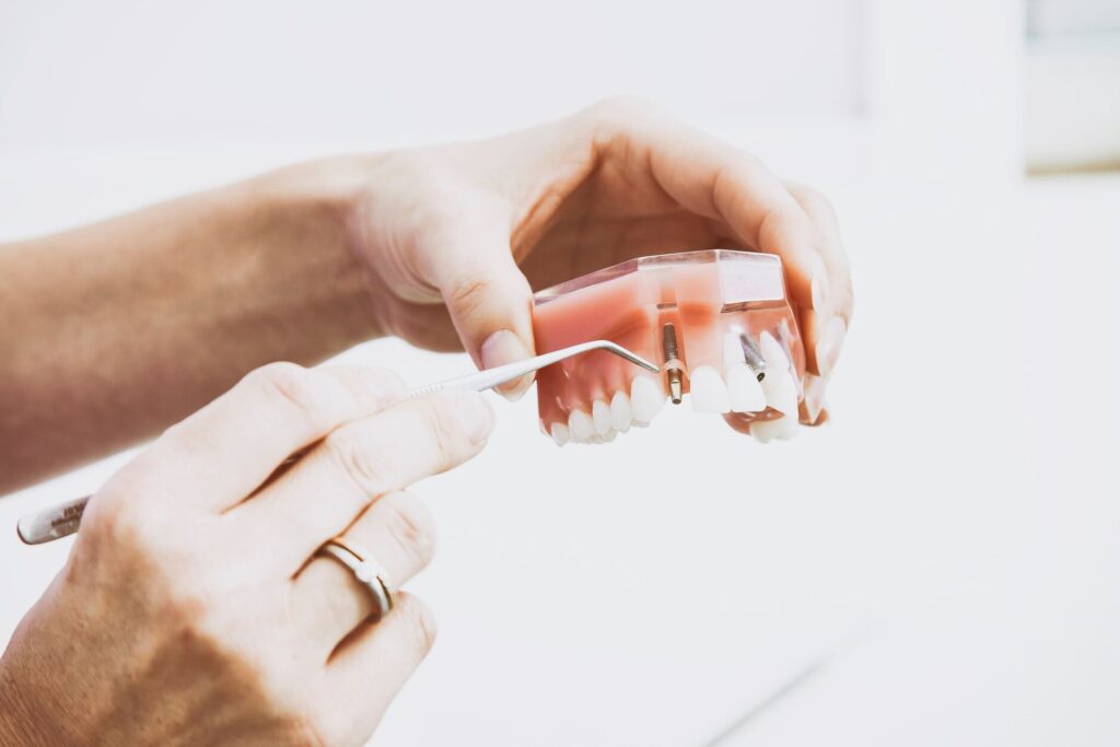 What is Implant Treatment?